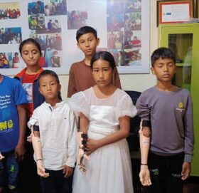 ज्योति विकास बैंकद्वारा बालबालिकाहरुलाई कृत्रिम हात प्रदान